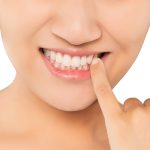 Parodontoza – inamicul dinților!